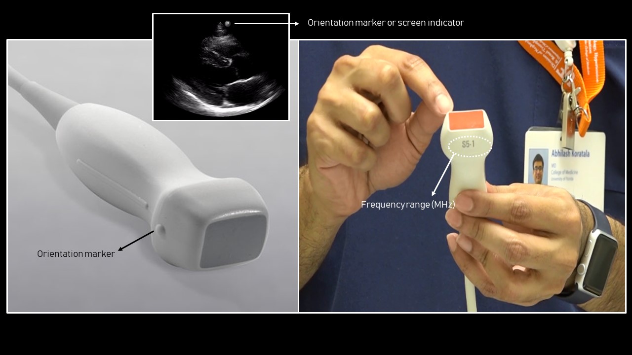 Introduction to Focused Cardiac Ultrasound The Parasternal Long Axis