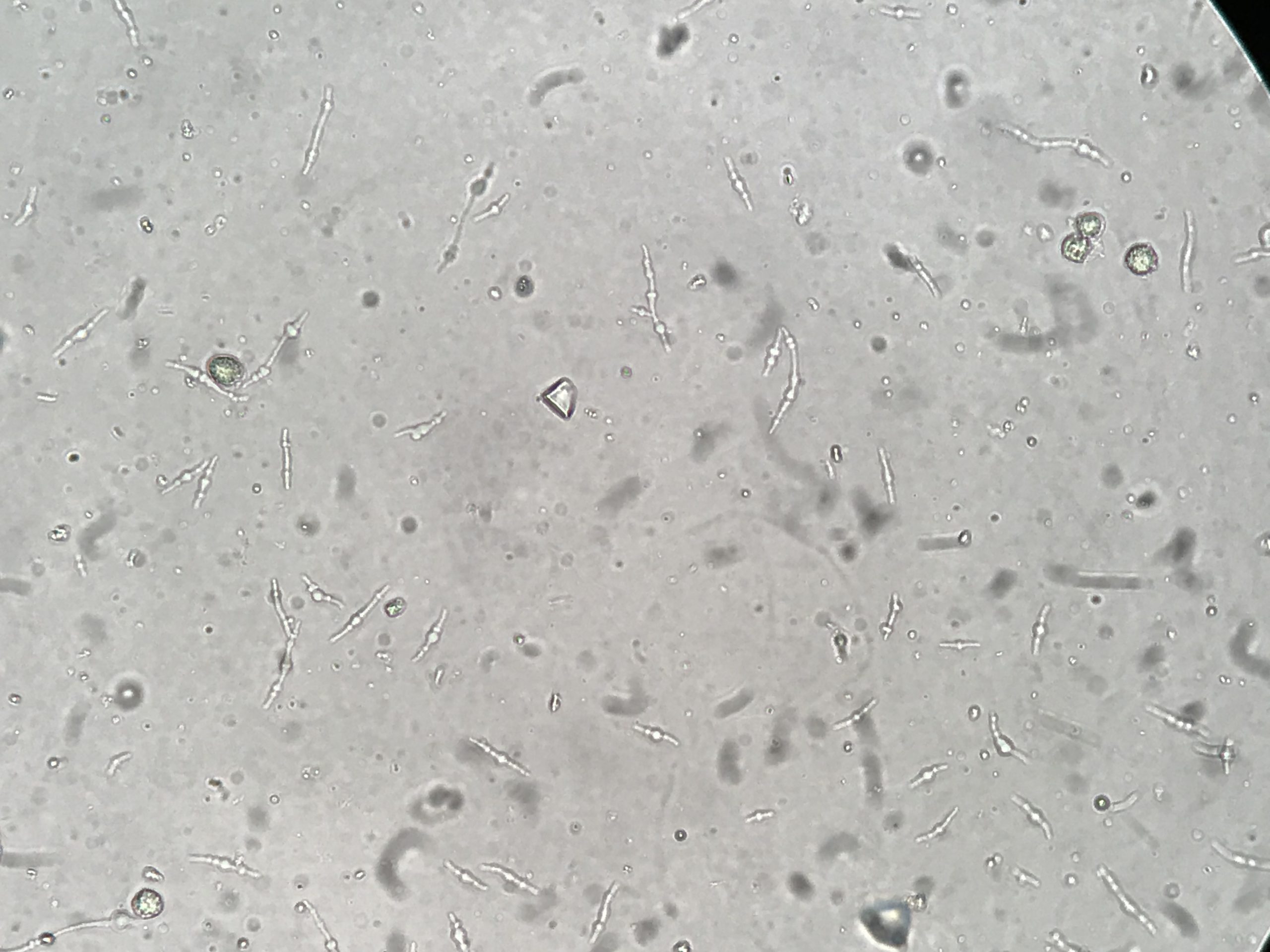 Bacteria In Urine Under Microscope bacteria-in-urine-under-microscope