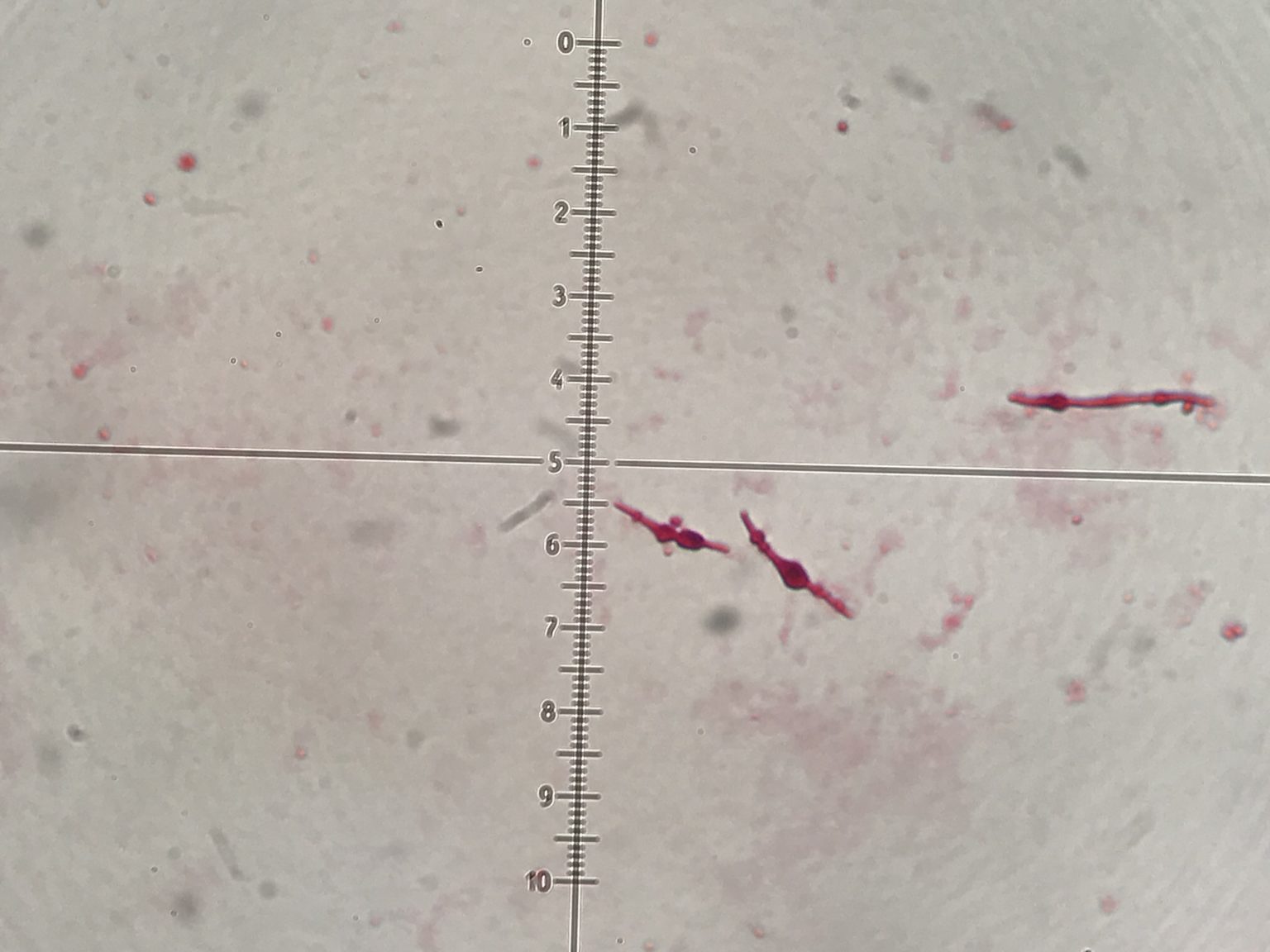 Urine Sediment of the Month Bacterial Variant Forms Renal Fellow Network