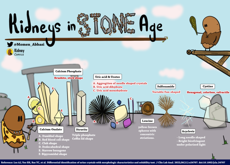 Kidney Comics: Kidneys in the Stone Age - Renal Fellow Network